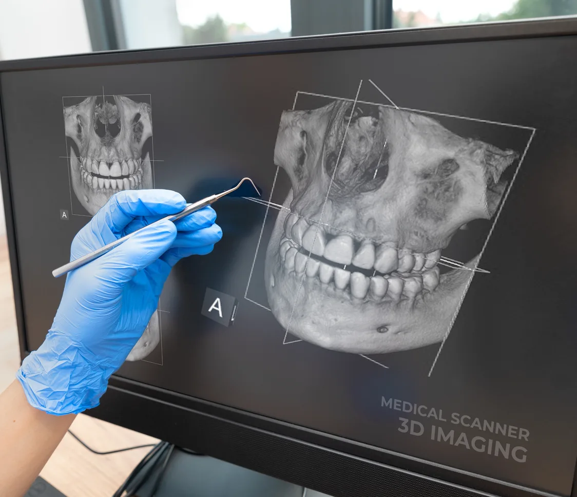 3D jaw scan imaging displayed on a medical scanner